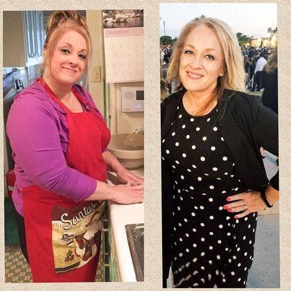 Bariatric Surgery Before & After Gallery - Patient 373843 - Image 1