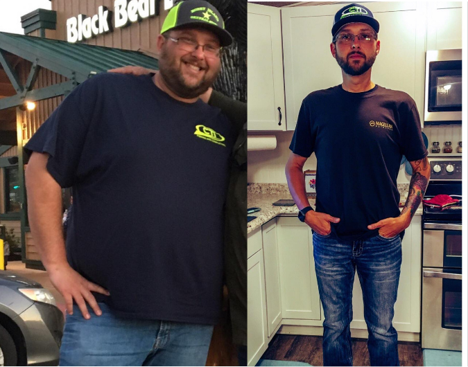 Bariatric Surgery Before & After Gallery - Patient 901682 - Image 1