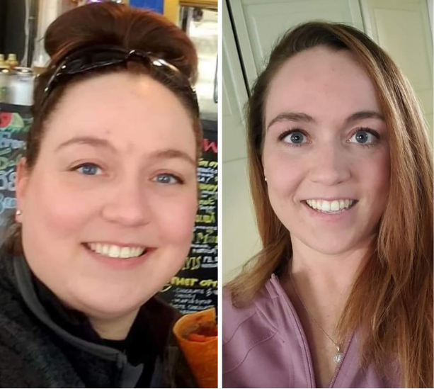 Bariatric Surgery Before & After Gallery - Patient 203793 - Image 1