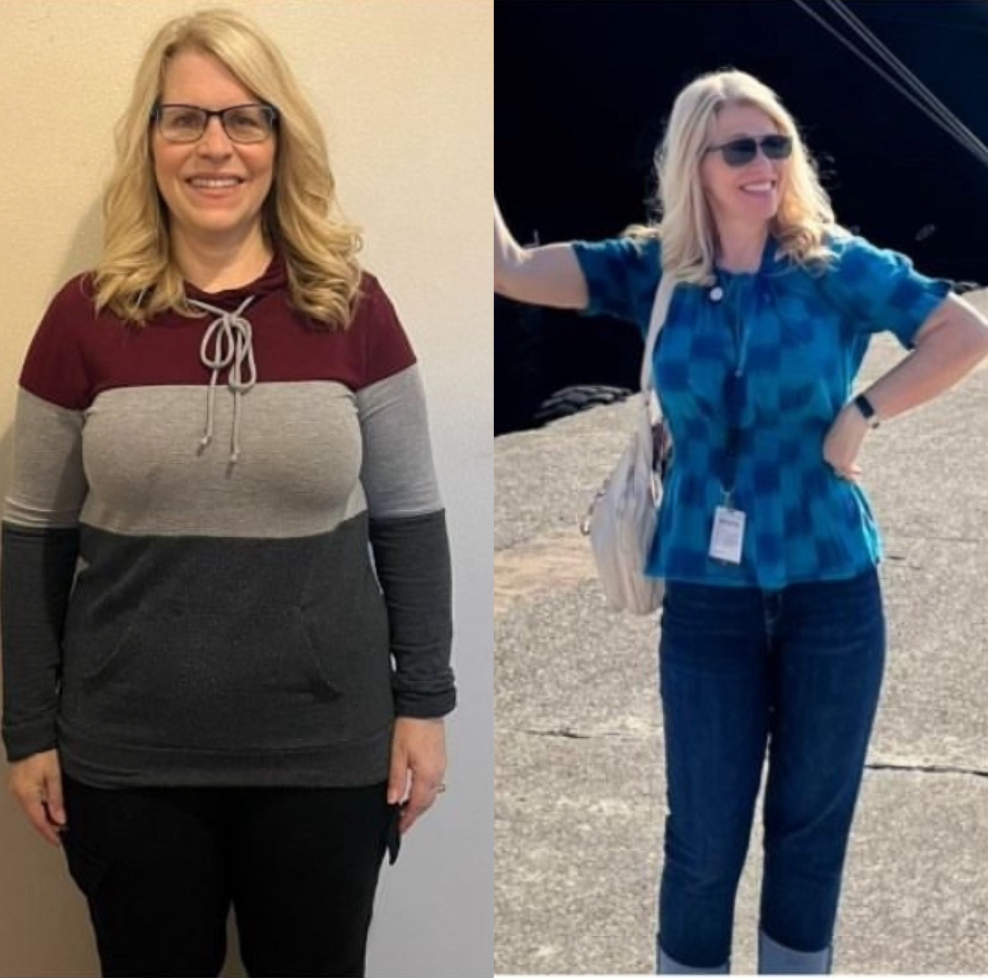 Bariatric Surgery Before & After Gallery - Patient 164994 - Image 1