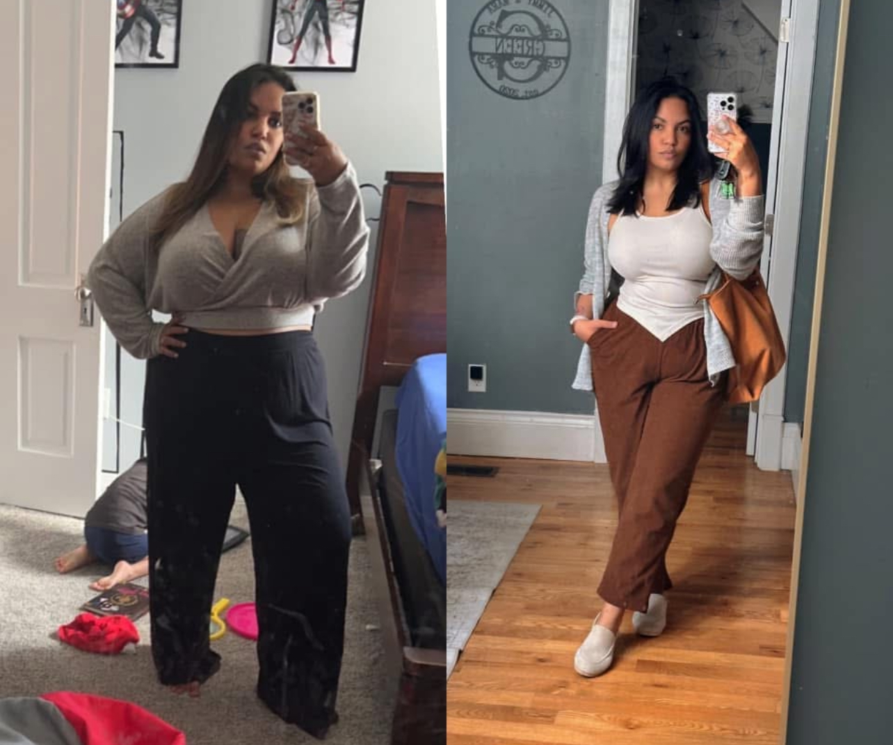 Bariatric Surgery Before & After Gallery - Patient 428538 - Image 1