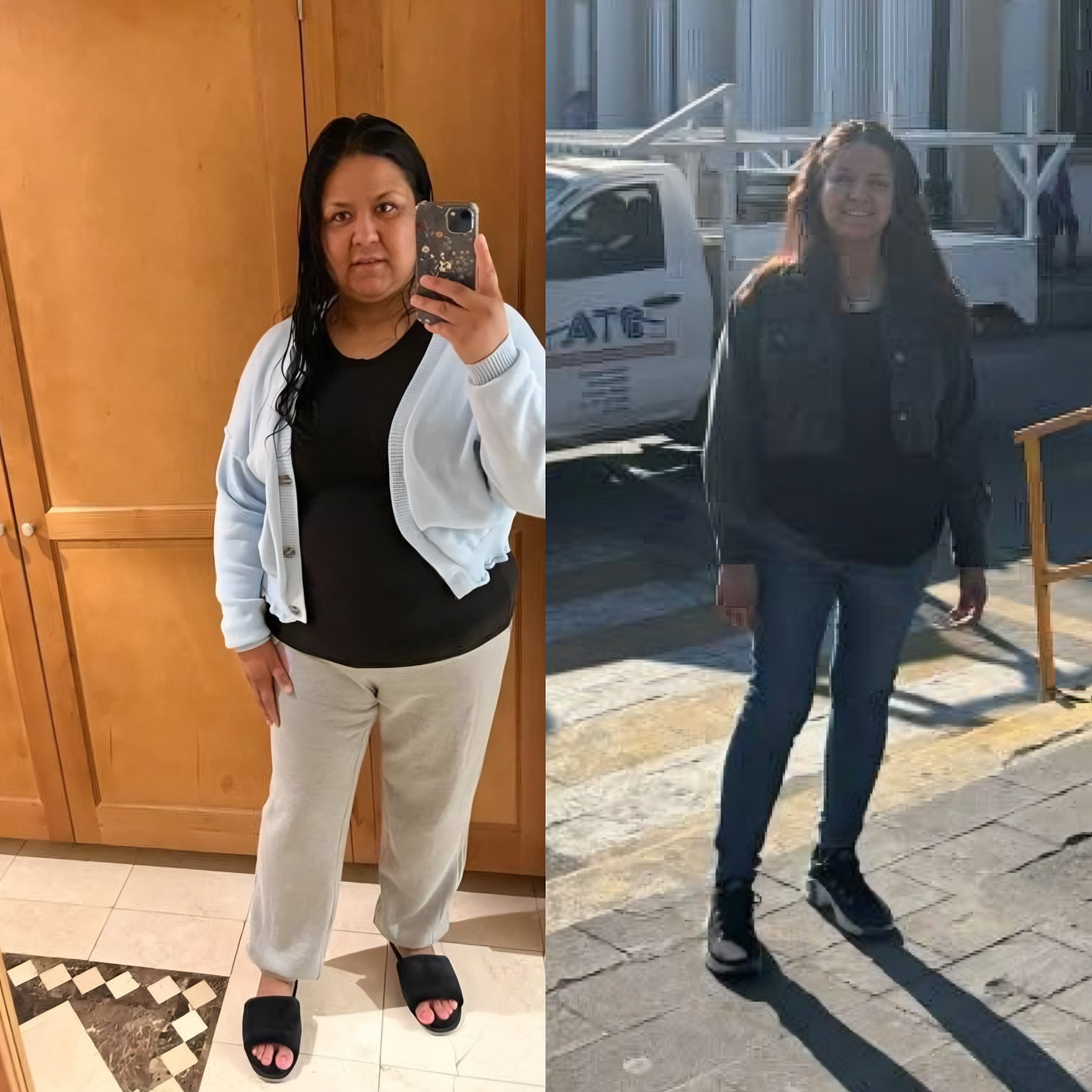 Bariatric Surgery Before & After Gallery - Patient 944736 - Image 1