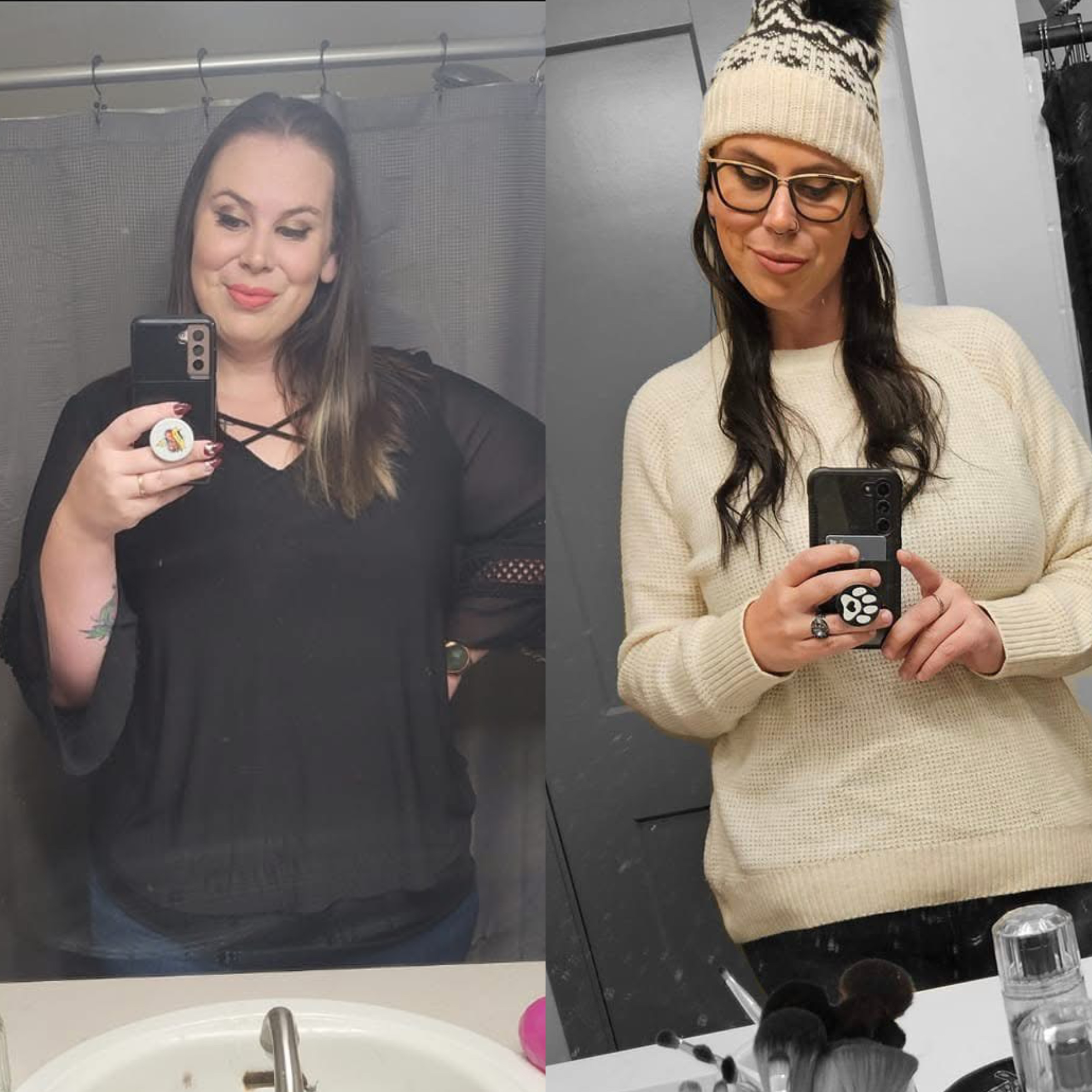 Bariatric Surgery Before & After Gallery - Patient 406075 - Image 1