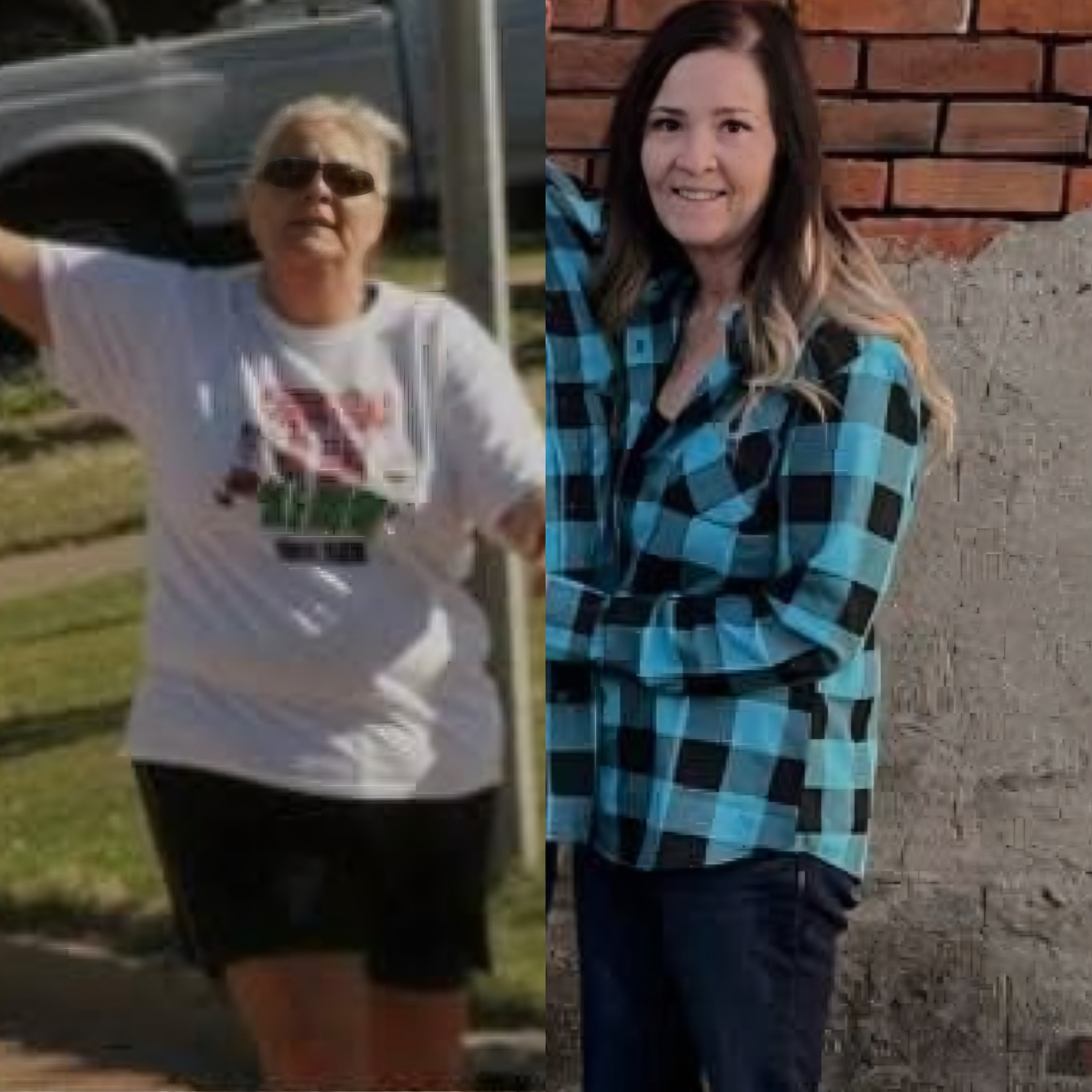 Bariatric Surgery Before & After Gallery - Patient 366534 - Image 1