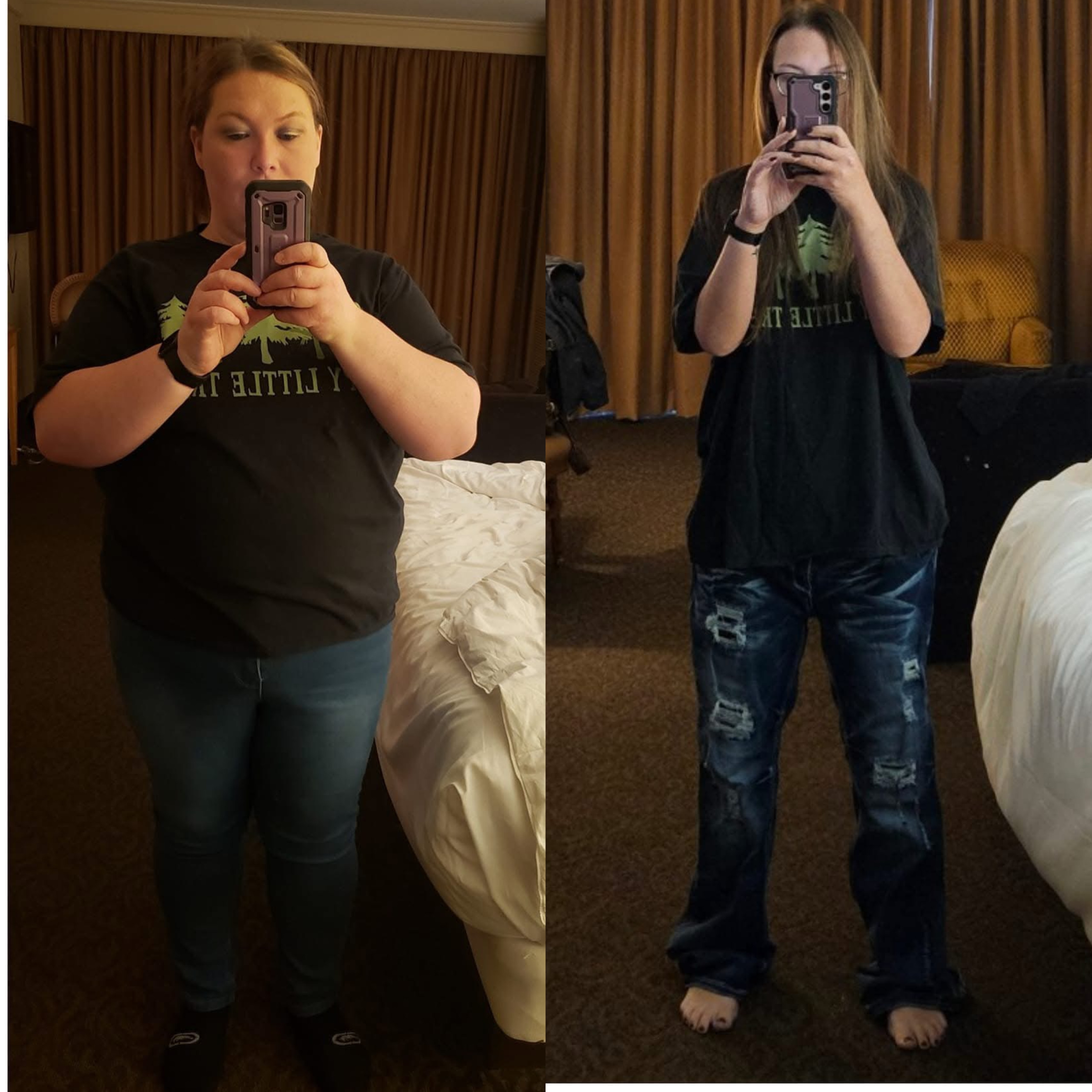 Bariatric Surgery Before & After Gallery - Patient 235343 - Image 1