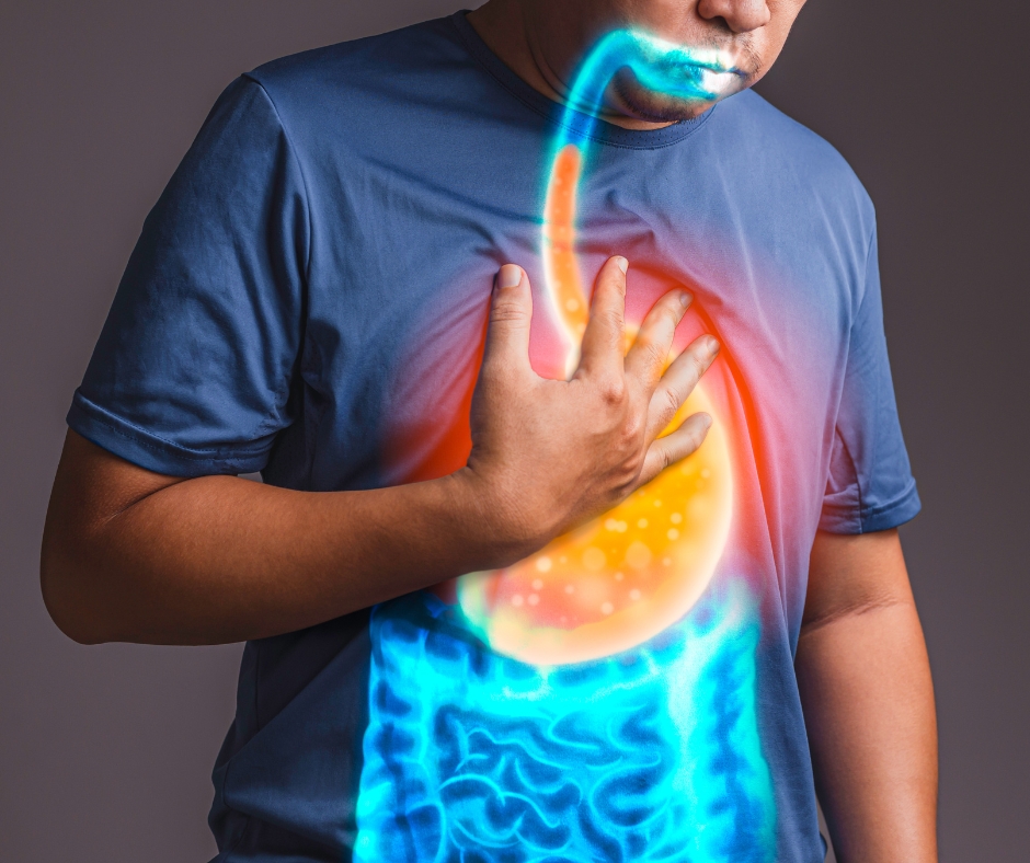 Illustration showing how persistent acid reflux and GERD affect the stomach and esophagus