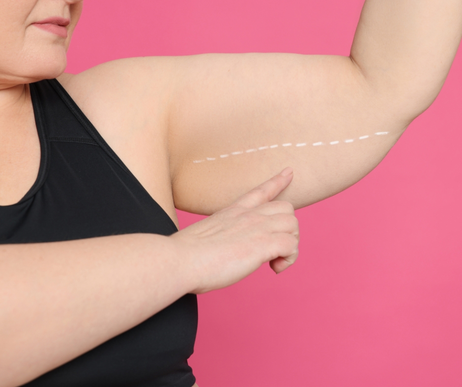 Plastic surgery consultation after major weight loss