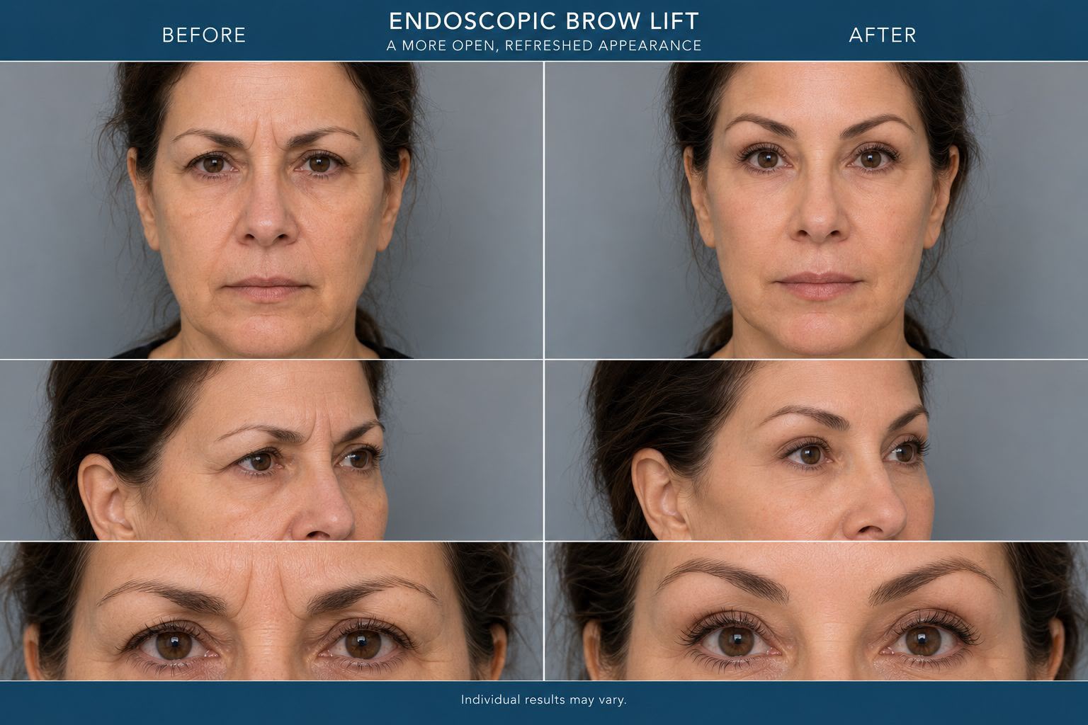Plastic surgery before and after patient result