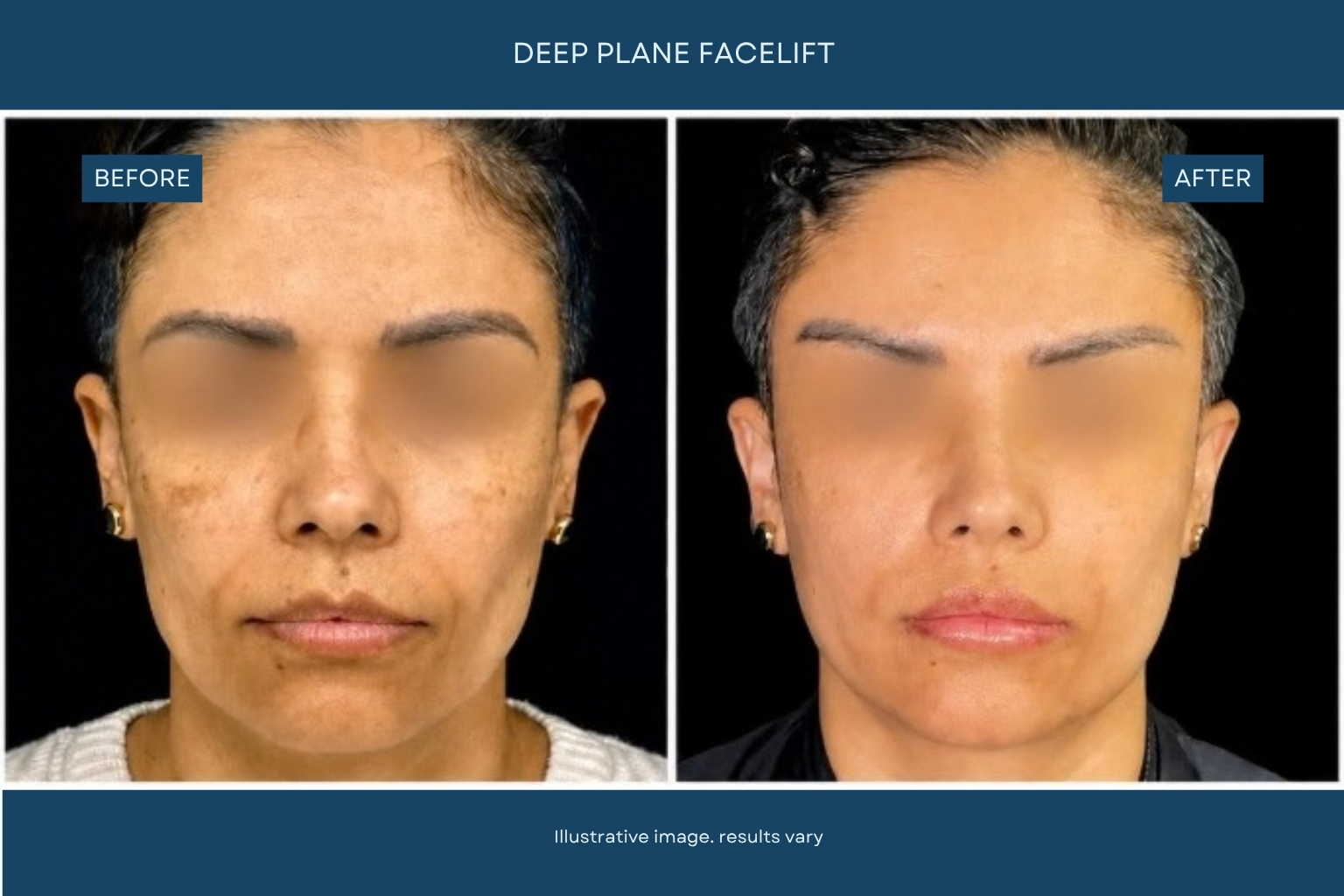 Plastic surgery before and after transformation