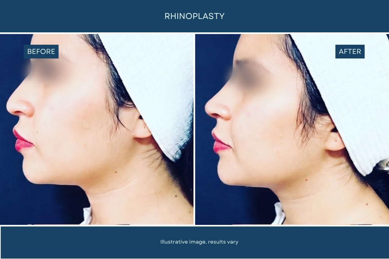 Plastic surgery patient transformation before and after