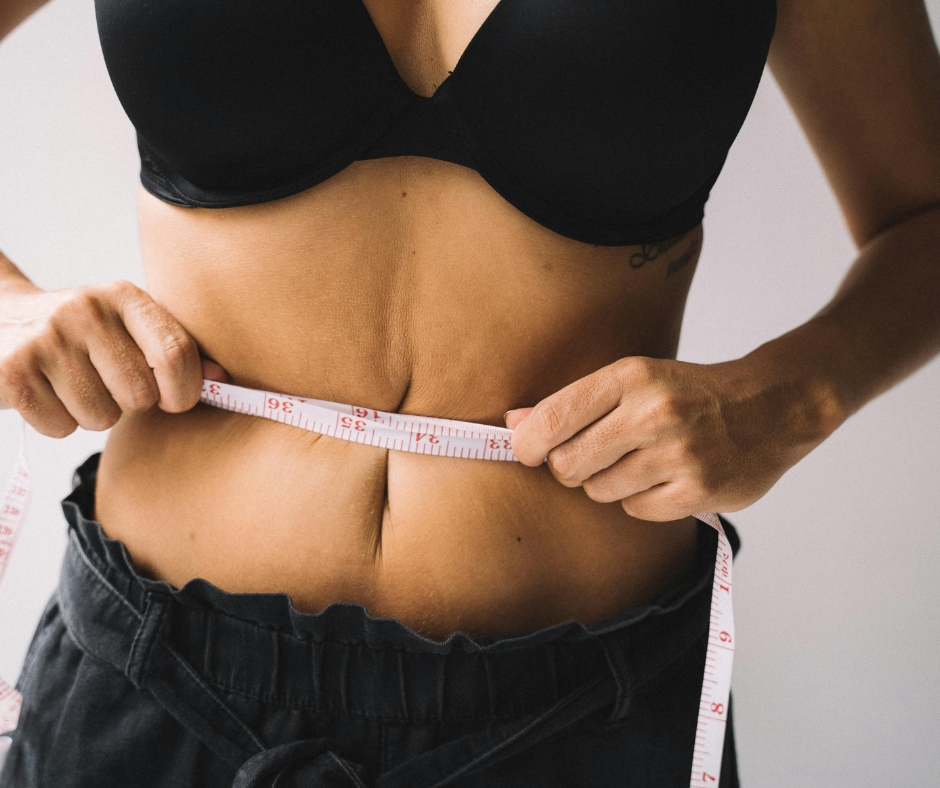 Tummy tuck consultation in Tijuana Mexico